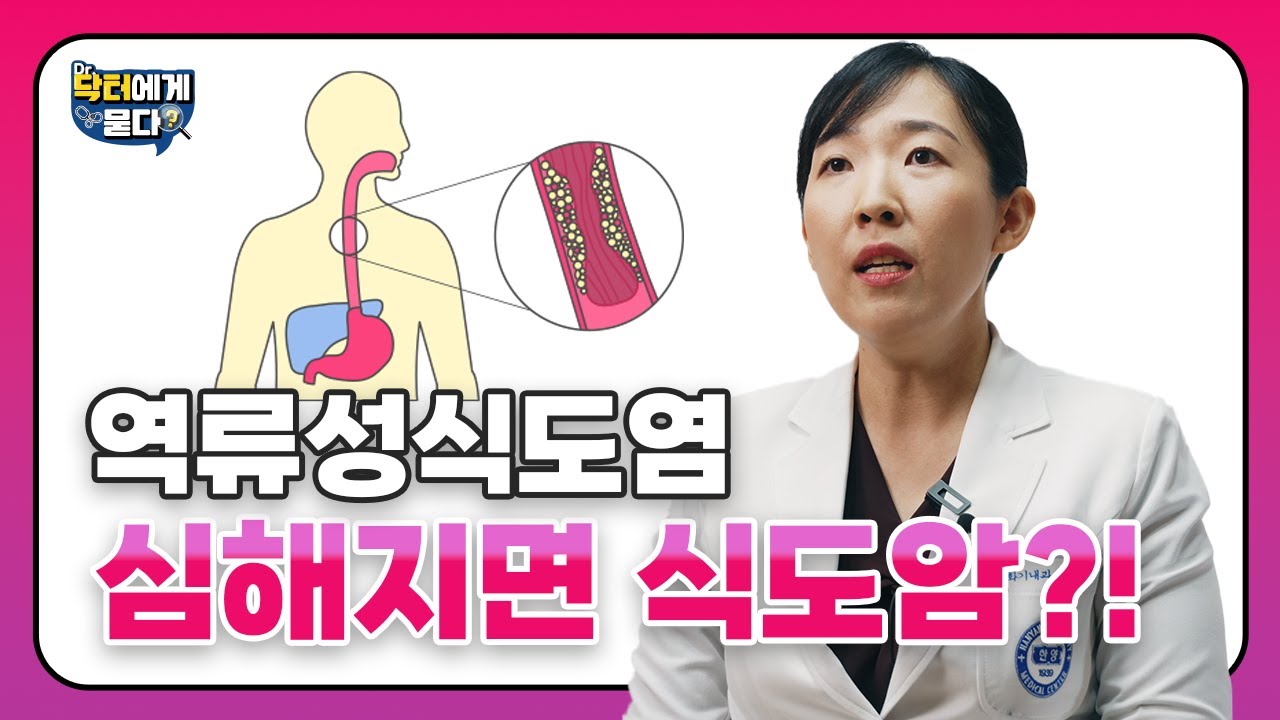 역류성식도염 심해지면 식도암?!